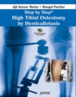 Step by Step: High Tibial Osteotomy by Hemicallotasis - Book