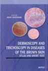 Dermoscopy and Trichoscopy in Diseases of the Brown Skin - Book