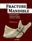 Fracture Mandible - Book