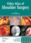 Video Atlas of Shoulder Surgery - Book