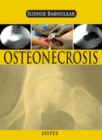 Osteonecrosis - Book