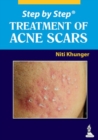 Step by Step: Treatment of Acne Scars - Book