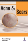 Acne & Scars - Book