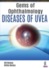 Gems of Ophthalmology: Diseases of Uvea - Book