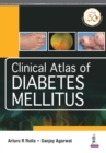 Clinical Atlas of Diabetes Mellitus - Book