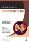 Clinical Focus on Endometriosis - Book