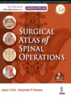 Surgical Atlas of Spinal Operations - Book