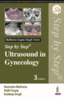 Step by Step Ultrasound in Gynecology - Book