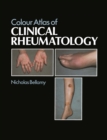 Colour Atlas of Clinical Rheumatology - eBook