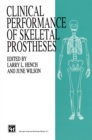 Clinical Performance of Skeletal Prostheses - eBook