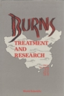 Burns: Treatment And Research - eBook