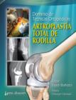 Dominio De Tecnicas Ortopedicas: Artroplastia Total De Rodilla - Book