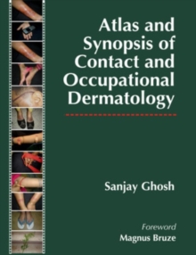 Atlas and Synopsis of Contact and Occupational Dermatology, Hardback Book Atlas and Synopsis of Contact and Occupational Dermatology, Hardback Book