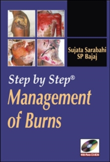 Step by Step Management of Burns, DVD video Book Step by Step Management of Burns, DVD video Book