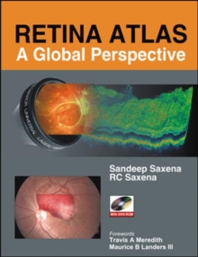 Retina Atlas: A Global Perspective, Hardback Book Retina Atlas: A Global Perspective, Hardback Book