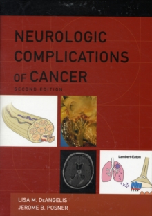 Neurologic Complications of Cancer, Hardback Book Neurologic Complications of Cancer, Hardback Book