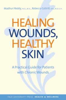 Healing Wounds, Healthy Skin : A Practical Guide for Patients with Chronic Wounds, Paperback / softback Book Healing Wounds, Healthy Skin : A Practical Guide for Patients with Chronic Wounds, Paperback / softback Book