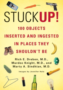 Stuck Up! : 100 Objects Inserted and Ingested in Places They Shouldn't be, Paperback Book Stuck Up! : 100 Objects Inserted and Ingested in Places They Shouldn't be, Paperback Book