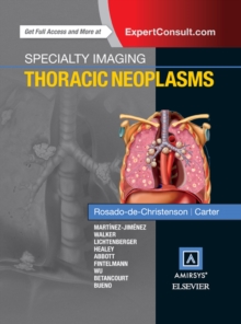 Specialty Imaging: Thoracic Neoplasms E-Book : Specialty Imaging: Thoracic Neoplasms E-Book