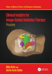 Clinical Insights for Image-Guided Radiotherapy : Prostate