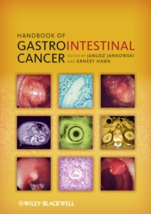 Handbook of Gastrointestinal Cancer, Paperback / softback Book Handbook of Gastrointestinal Cancer, Paperback / softback Book