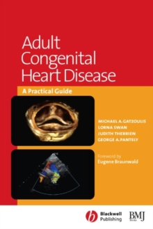 Adult Congenital Heart Disease : A Practical Guide, Paperback / softback Book Adult Congenital Heart Disease : A Practical Guide, Paperback / softback Book