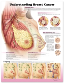 Understanding Breast Cancer 3E Laminated, Wallchart Book Understanding Breast Cancer 3E Laminated, Wallchart Book