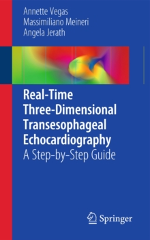 Real-Time Three-Dimensional Transesophageal Echocardiography : A Step-by-Step Guide, Paperback / softback Book Real-Time Three-Dimensional Transesophageal Echocardiography : A Step-by-Step Guide, Paperback / softback Book