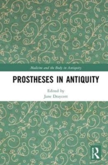 Prostheses in Antiquity, Hardback Book Prostheses in Antiquity, Hardback Book