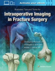 Illustrated Tips and Tricks for Intraoperative Imaging in Fracture Surgery, Hardback Book Illustrated Tips and Tricks for Intraoperative Imaging in Fracture Surgery, Hardback Book