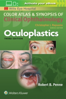 Oculoplastics, Paperback / softback Book Oculoplastics, Paperback / softback Book