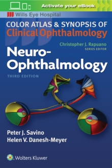 Neuro-Ophthalmology, Paperback / softback Book Neuro-Ophthalmology, Paperback / softback Book