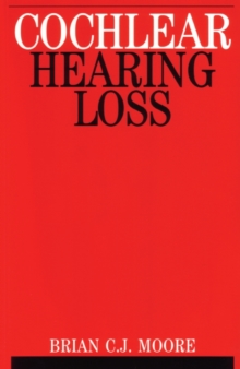 Cochlear Hearing Loss, Paperback / softback Book Cochlear Hearing Loss, Paperback / softback Book