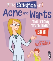 The Science Of Acne & Warts : The Itchy Truth About Skin