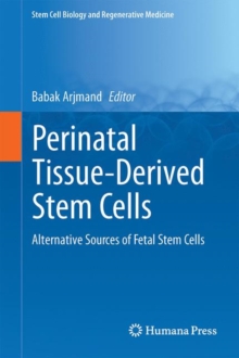 Perinatal Tissue-Derived Stem Cells : Alternative Sources of Fetal Stem Cells