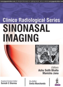 Clinico Radiological Series: Sinonasal Imaging, Paperback / softback Book Clinico Radiological Series: Sinonasal Imaging, Paperback / softback Book