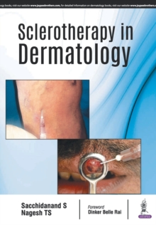 Sclerotherapy in Dermatology, Paperback / softback Book Sclerotherapy in Dermatology, Paperback / softback Book