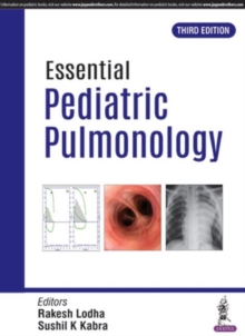 Essential Pediatric Pulmonology, Paperback / softback Book Essential Pediatric Pulmonology, Paperback / softback Book