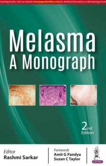 Melasma: A Monograph, Paperback / softback Book Melasma: A Monograph, Paperback / softback Book