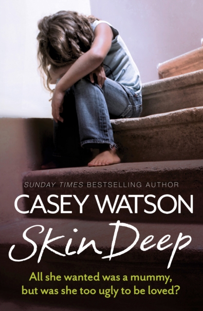 Skin Deep : All She Wanted Was a Mummy, But Was She Too Ugly to Be Loved?, EPUB eBook