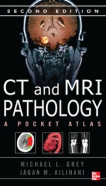 CT & MRI Pathology: A Pocket Atlas, Second Edition, PDF eBook