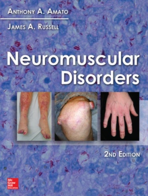 Neuromuscular Disorders, Hardback Book