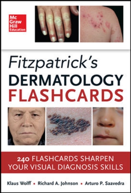 Fitzpatricks Dermatology Flash Cards, Paperback / softback Book