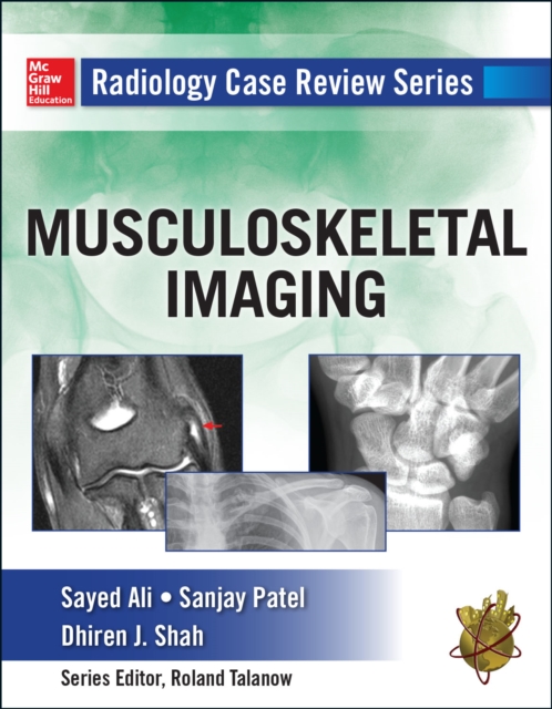 Radiology Case Review Series: MSK Imaging, EPUB eBook