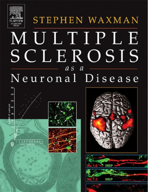 Multiple Sclerosis As A Neuronal Disease, EPUB eBook