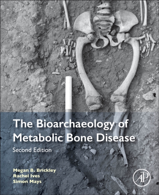 The Bioarchaeology of Metabolic Bone Disease, Paperback / softback Book