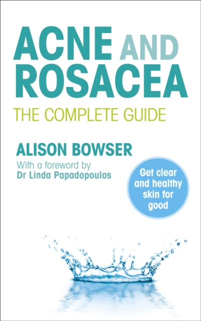 Acne and Rosacea : The Complete Guide, Paperback / softback Book