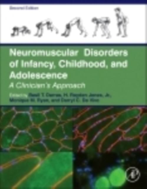 Neuromuscular Disorders of Infancy, Childhood, and Adolescence : A Clinician's Approach, PDF eBook