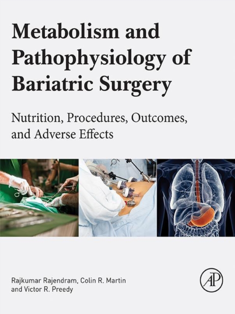 Metabolism and Pathophysiology of Bariatric Surgery : Nutrition, Procedures, Outcomes and Adverse Effects, EPUB eBook