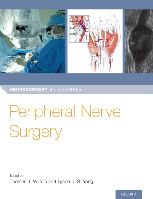 Peripheral Nerve Surgery, Paperback / softback Book